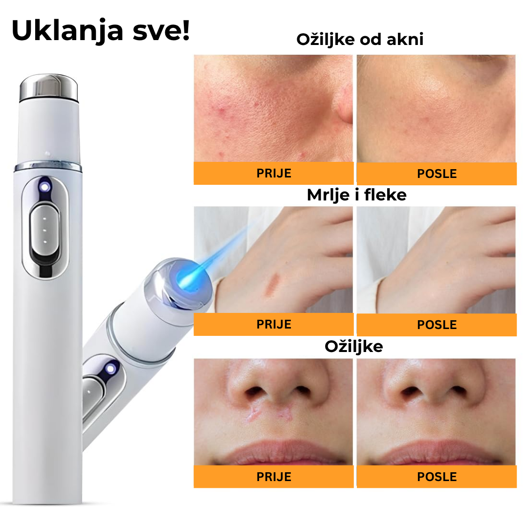 LASERSKA OLOVKA ZA DERMATOLOŠKE PROBLEME