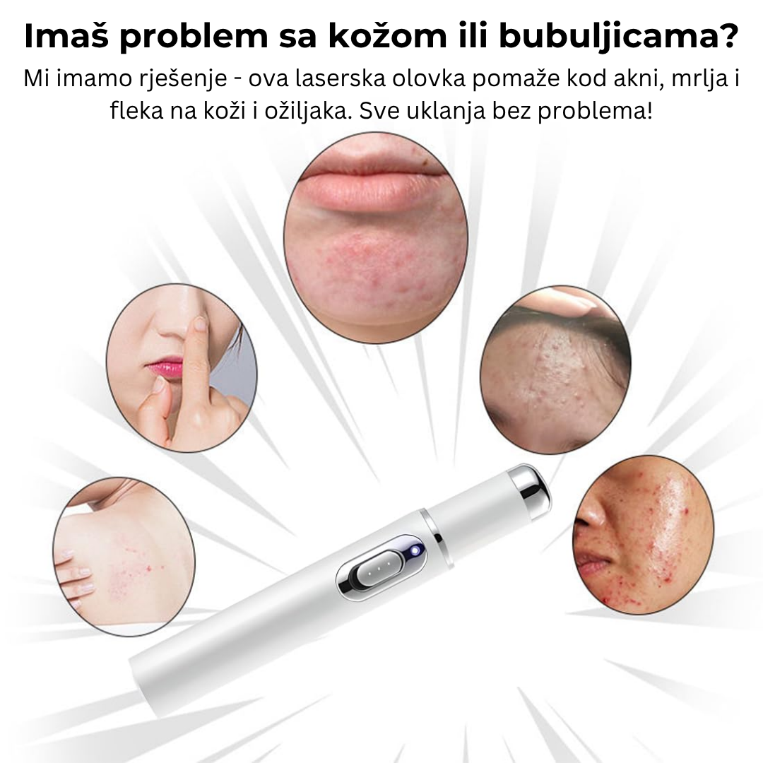 LASERSKA OLOVKA ZA DERMATOLOŠKE PROBLEME